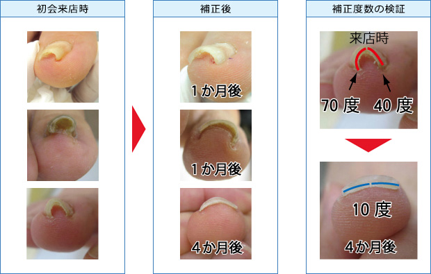 治療の経過イメージ